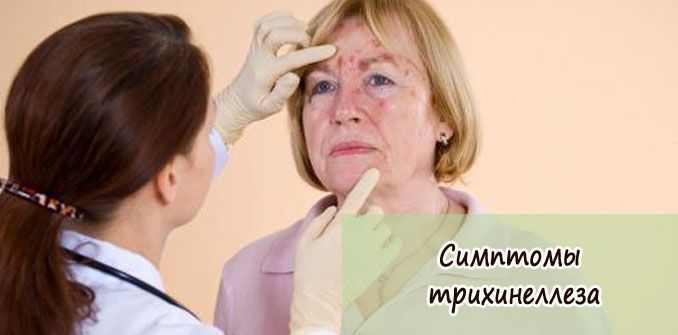 Все симптомы трихинеллеза у человека: с фото и описанием - Все для ...