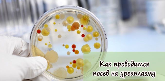 Как происходит посев на уреаплазму у мужчин и женщин? - Все для очистки ...